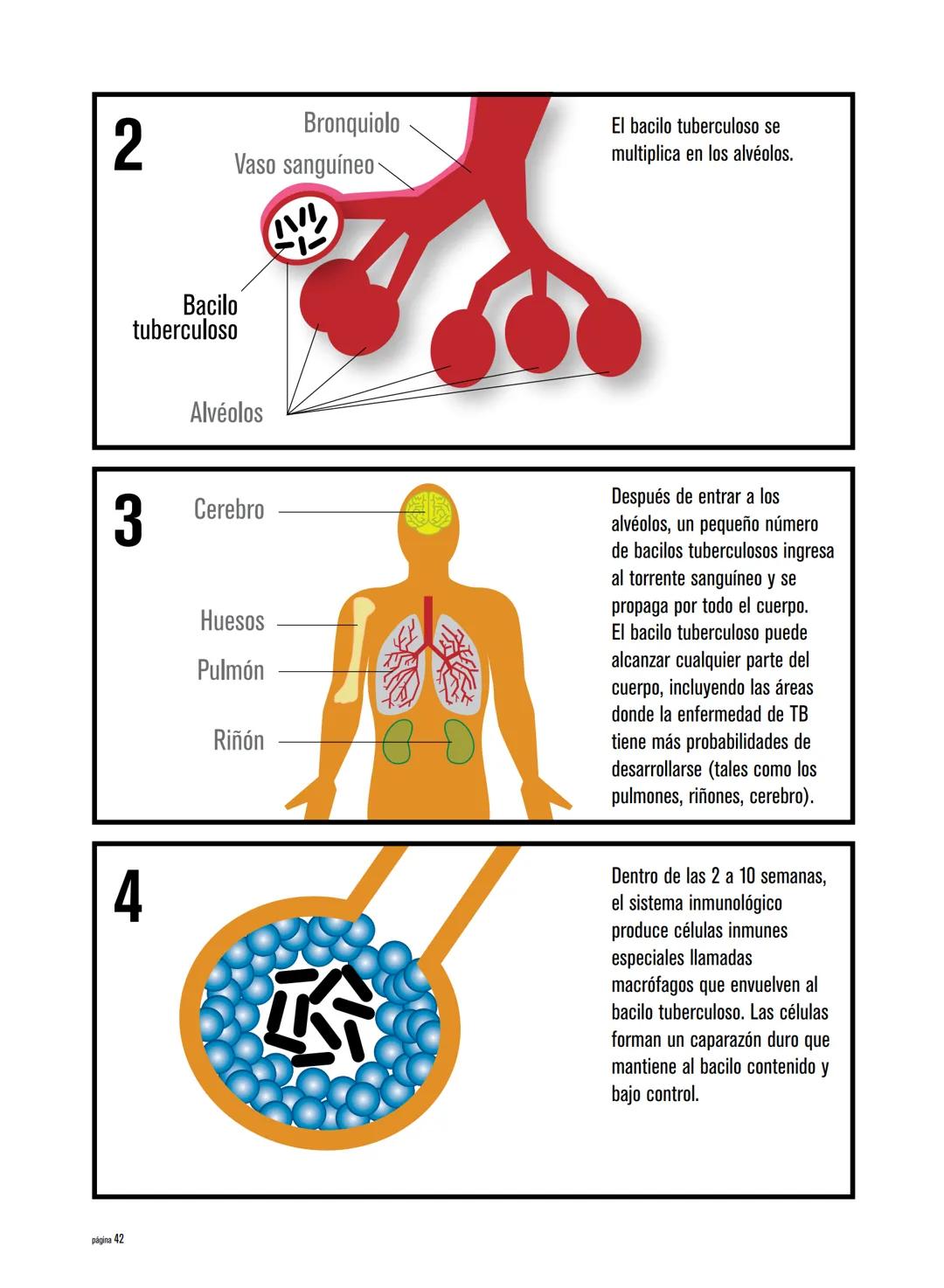 Generalidades sobre la tuberculosis
La tuberculosis (TB) es una enfermedad causada por un or-
ganismo denominado Mycobacterium tuberculosis 