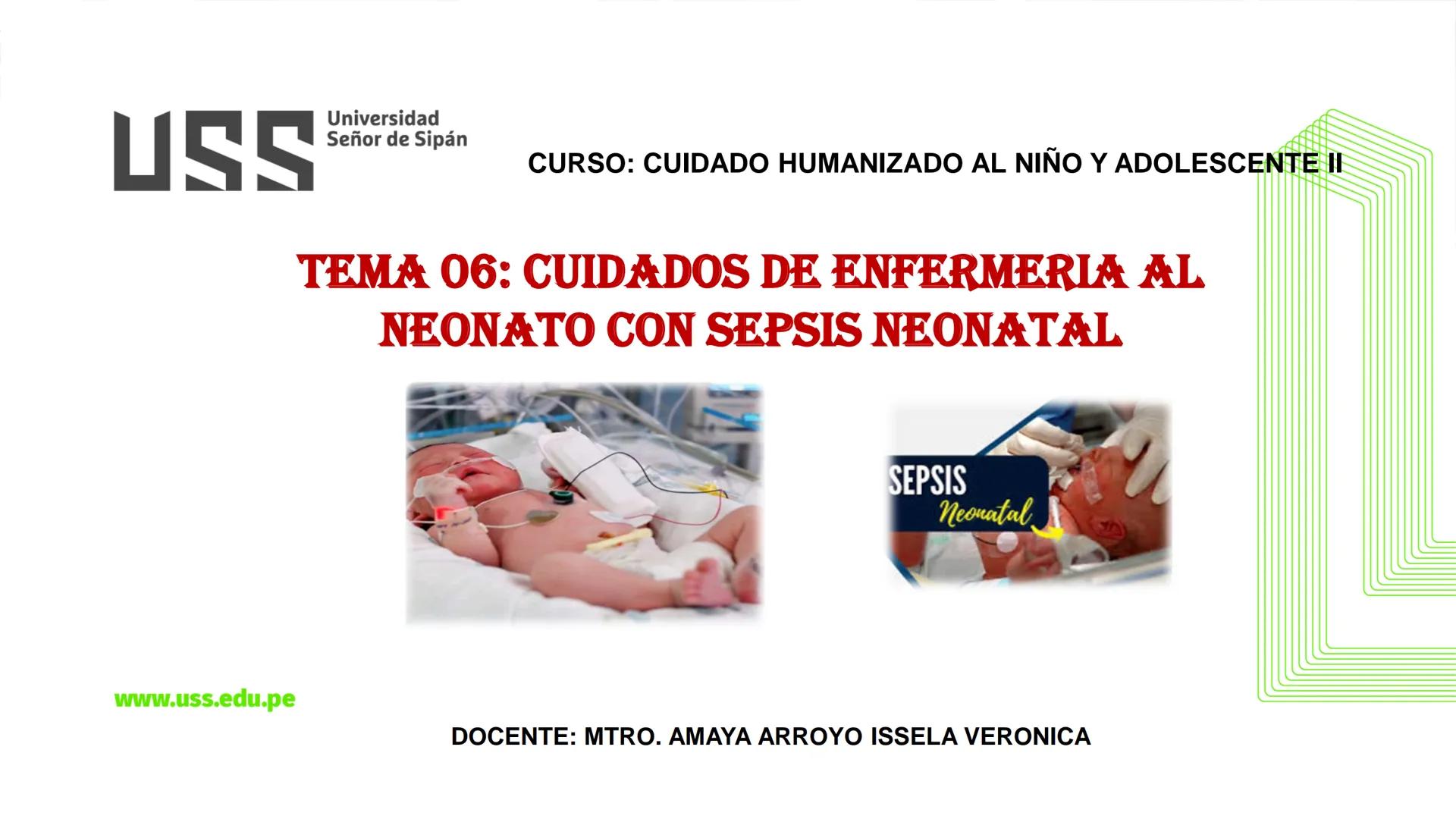 # USS

Universidad
Señor de Sipán

CURSO: CUIDADO HUMANIZADO AL NIÑO Y ADOLESCENTE II

# TEMA 06: CUIDADOS DE ENFERMERIA AL
# NEONATO CON SE