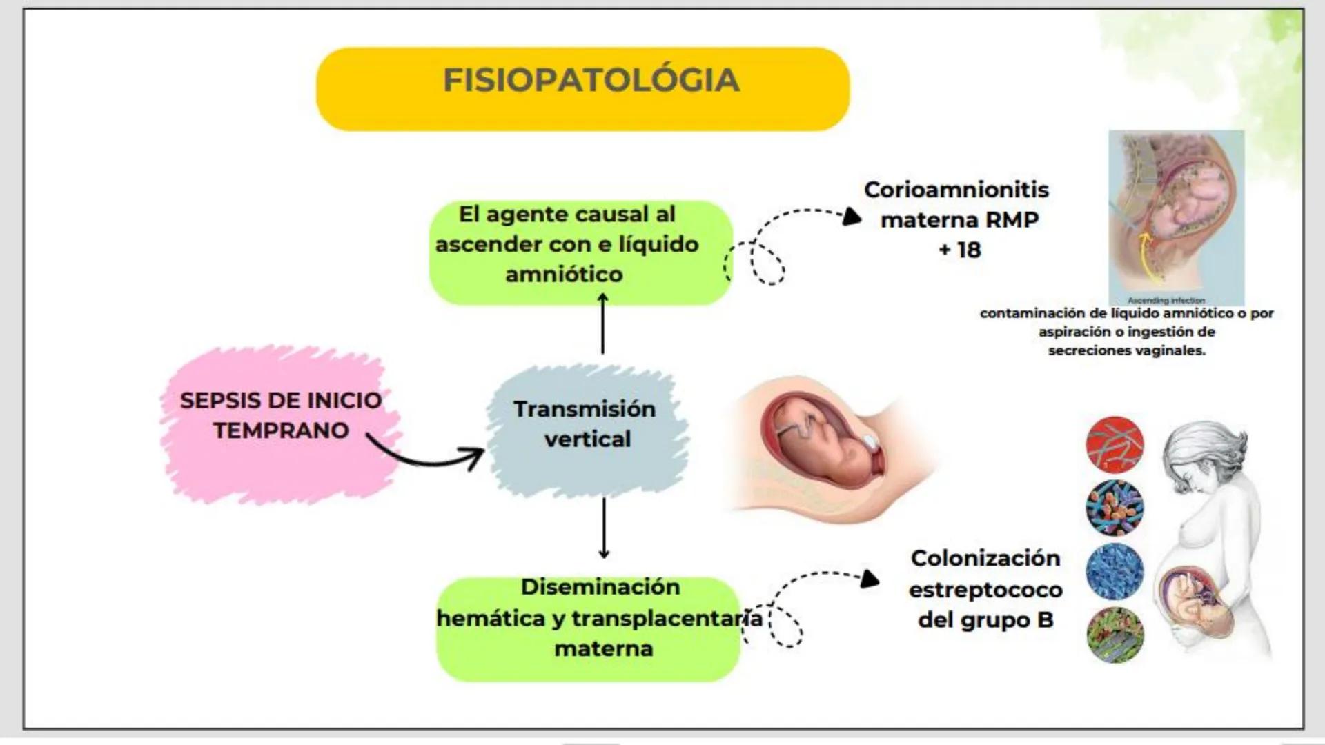 # USS

Universidad
Señor de Sipán

CURSO: CUIDADO HUMANIZADO AL NIÑO Y ADOLESCENTE II

# TEMA 06: CUIDADOS DE ENFERMERIA AL
# NEONATO CON SE