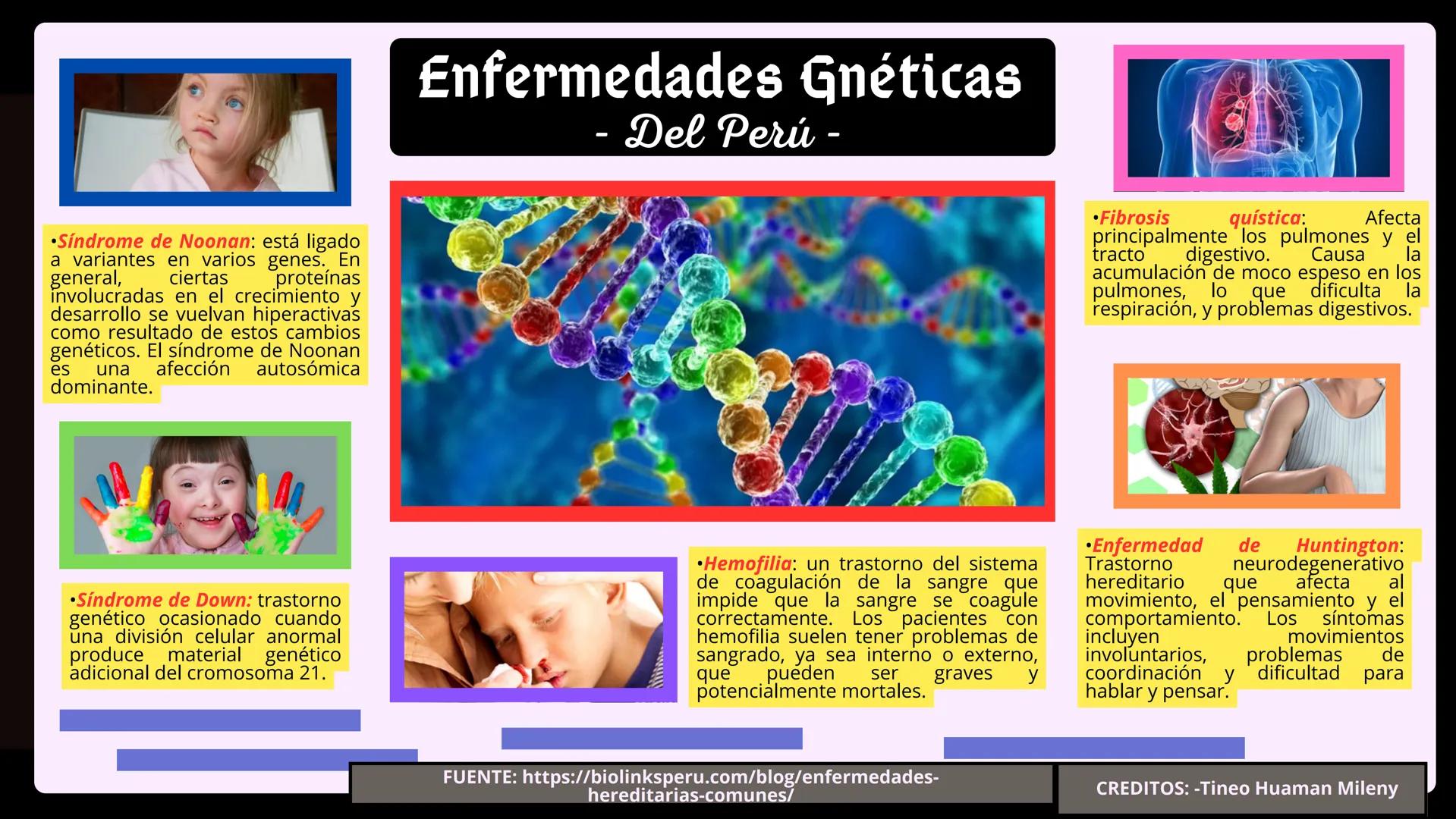 # Enfermedades Gnéticas
- Del Perú -
•Síndrome de Noonan: está ligado
a variantes en varios genes. En
general, ciertas proteínas
involucra