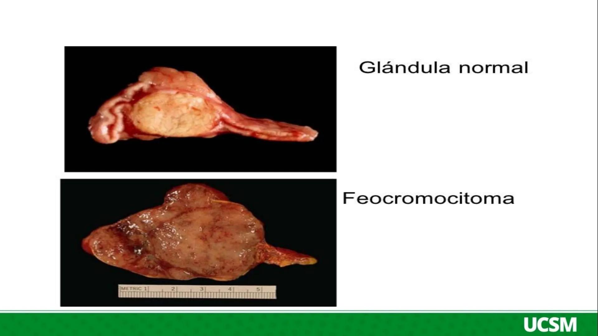 # Universidad Católica
de Santa María
SALUD Y ENFERMEDAD
• Mtro: FERNANDO TORRES VELA # FISIOPATOLOGIA
- La fisiopatología es el estudio