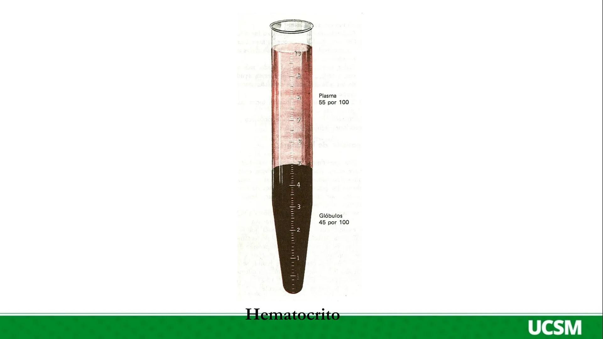 # Universidad Católica
## de Santa María
# FISIOLOGIA DE LA SANGRE
Mtro: FERNANDO TORRES VELA # SANGRE
• La sangre esta compuesta por un