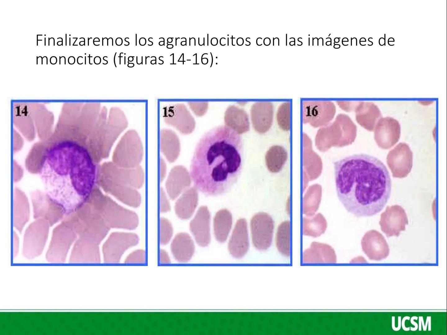 Universidad Católica
de Santa María
FISIOLOGIA DE LA SANGRE 2
Mtro: FERNANDO TORRES VELA # LEUCOCITOS
* Son células de color blanco (glóbul