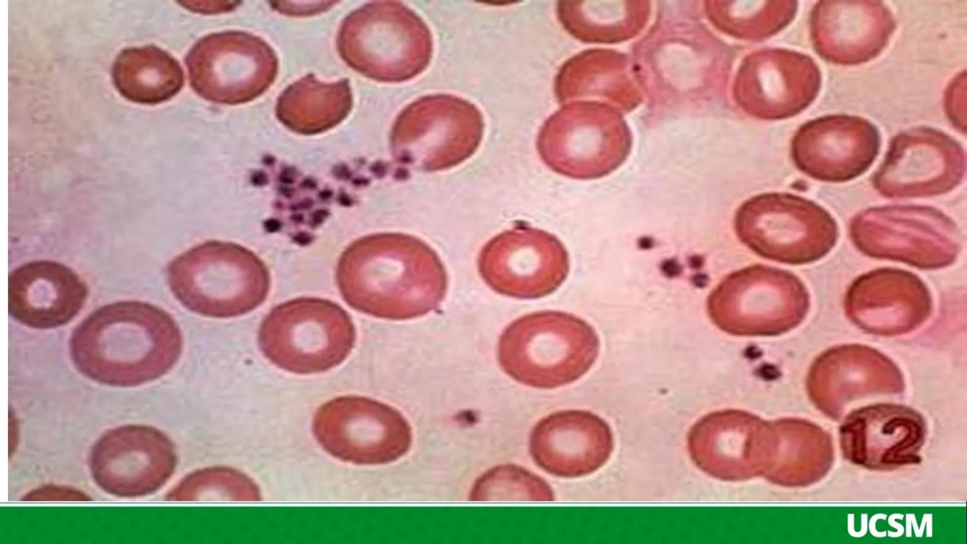 Universidad Católica
de Santa María
FISIOLOGIA DE LA SANGRE III
Mtro: FERNANDO TORRES VELA # Plaquetas o Trombocitos:
- Las plaquetas o tro