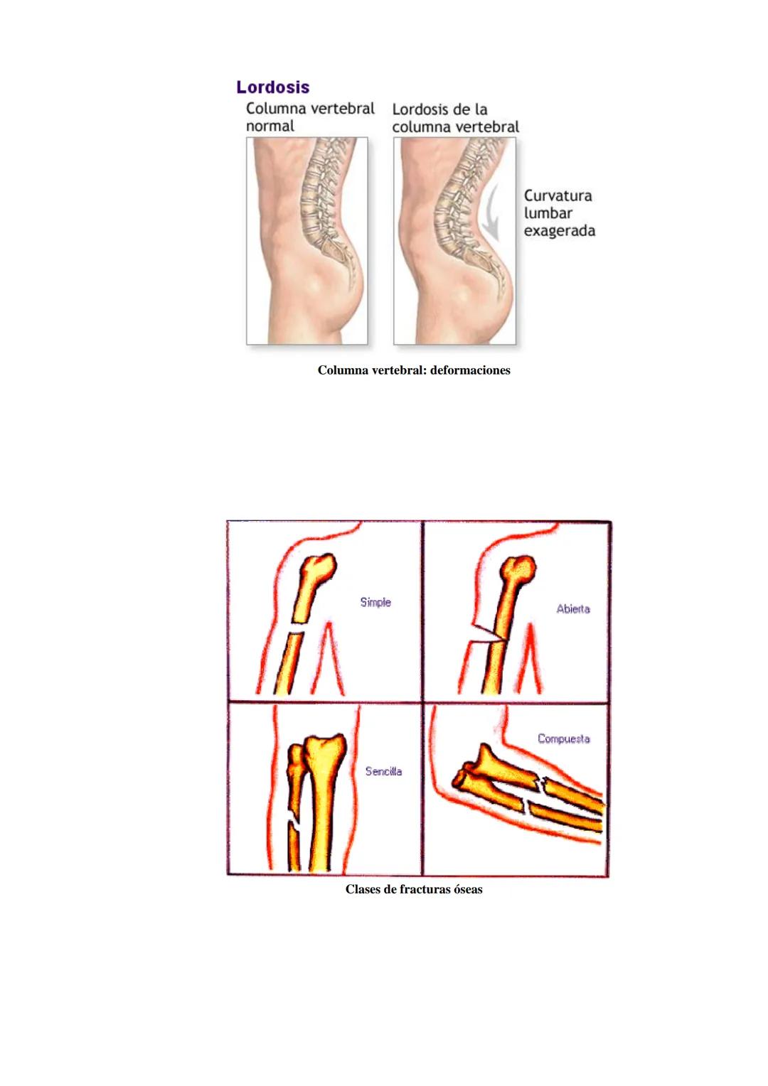 # SISTEMA ESQUELÉTICO: FUNCIONES. HUESOS: ESTRUCTURA Y CLASIFICACIÓN.
HISTOLOGIA DEL TEJIDO ÓSEO: CÉLULAS, TEJIDO ÓSEO COMPACTO Y TEJIDO
ÓSE