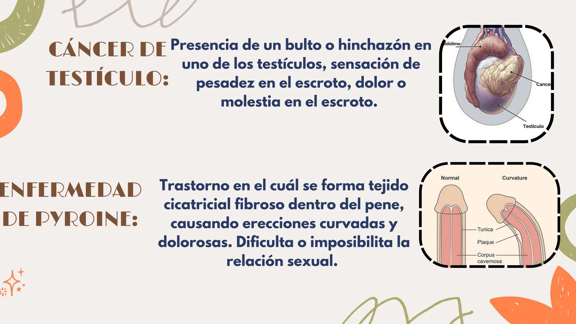 # APARATO REPRODUCTOR MASCULINO Aparato El aparato reproductor masculino es un
reproductor sistema complejo de órganos que trabajan
masculin