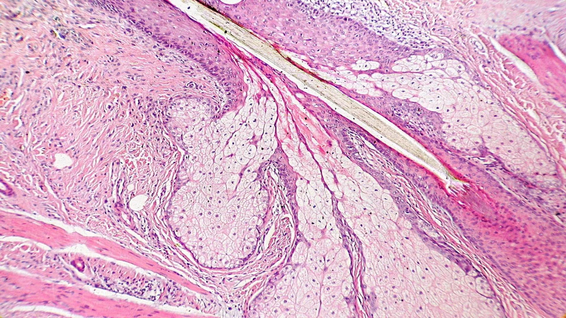 TRANSFORMA TU MUNDO EN
LA U MAS TOP DE LA REGIÓN. TEMA 01
HISTOLOGÍA DEL SISTEMA
TEGUMENTARIO
Curso: Estructura y Función 1
Docente: Silv