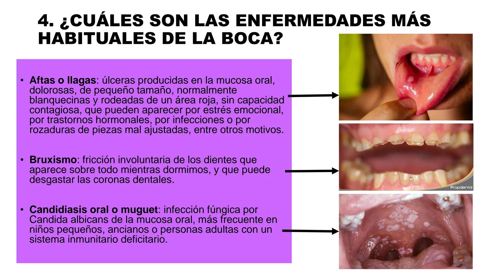 INSTITUTO
DE EDUCACION SUPERIOR TECNOLOGICO PUBLICO
* AYAVIRI *
Anatomía y Fisiología de
la Cavidad Oral
UNIDAD DIDACTICA: SALUD BUCAL # 1.