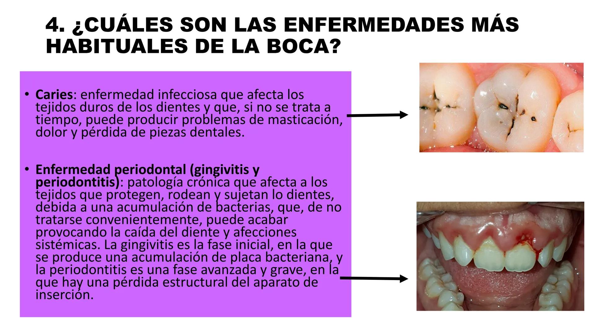 INSTITUTO
DE EDUCACION SUPERIOR TECNOLOGICO PUBLICO
* AYAVIRI *
Anatomía y Fisiología de
la Cavidad Oral
UNIDAD DIDACTICA: SALUD BUCAL # 1.