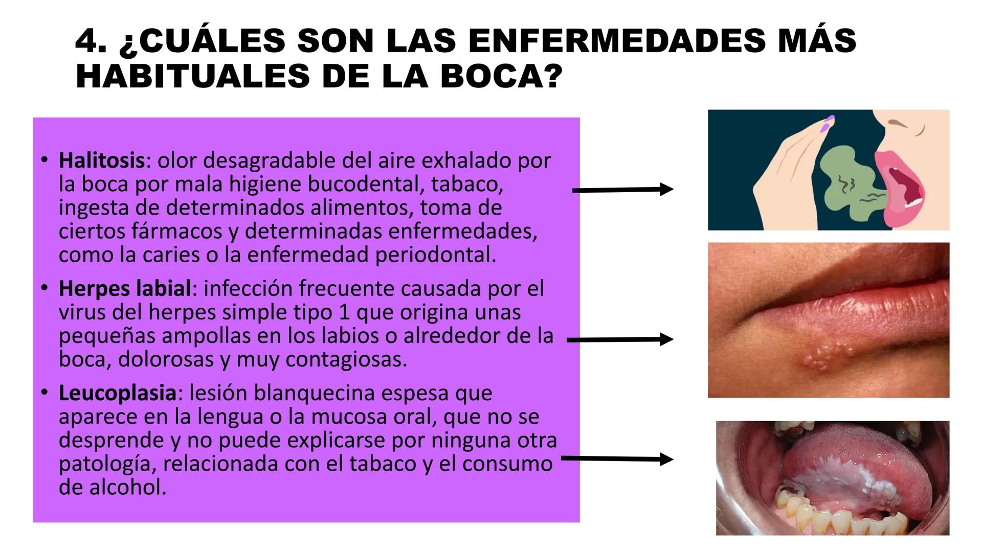 INSTITUTO
DE EDUCACION SUPERIOR TECNOLOGICO PUBLICO
* AYAVIRI *
Anatomía y Fisiología de
la Cavidad Oral
UNIDAD DIDACTICA: SALUD BUCAL # 1.