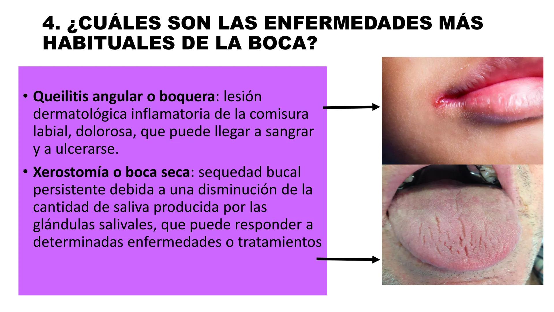 INSTITUTO
DE EDUCACION SUPERIOR TECNOLOGICO PUBLICO
* AYAVIRI *
Anatomía y Fisiología de
la Cavidad Oral
UNIDAD DIDACTICA: SALUD BUCAL # 1.