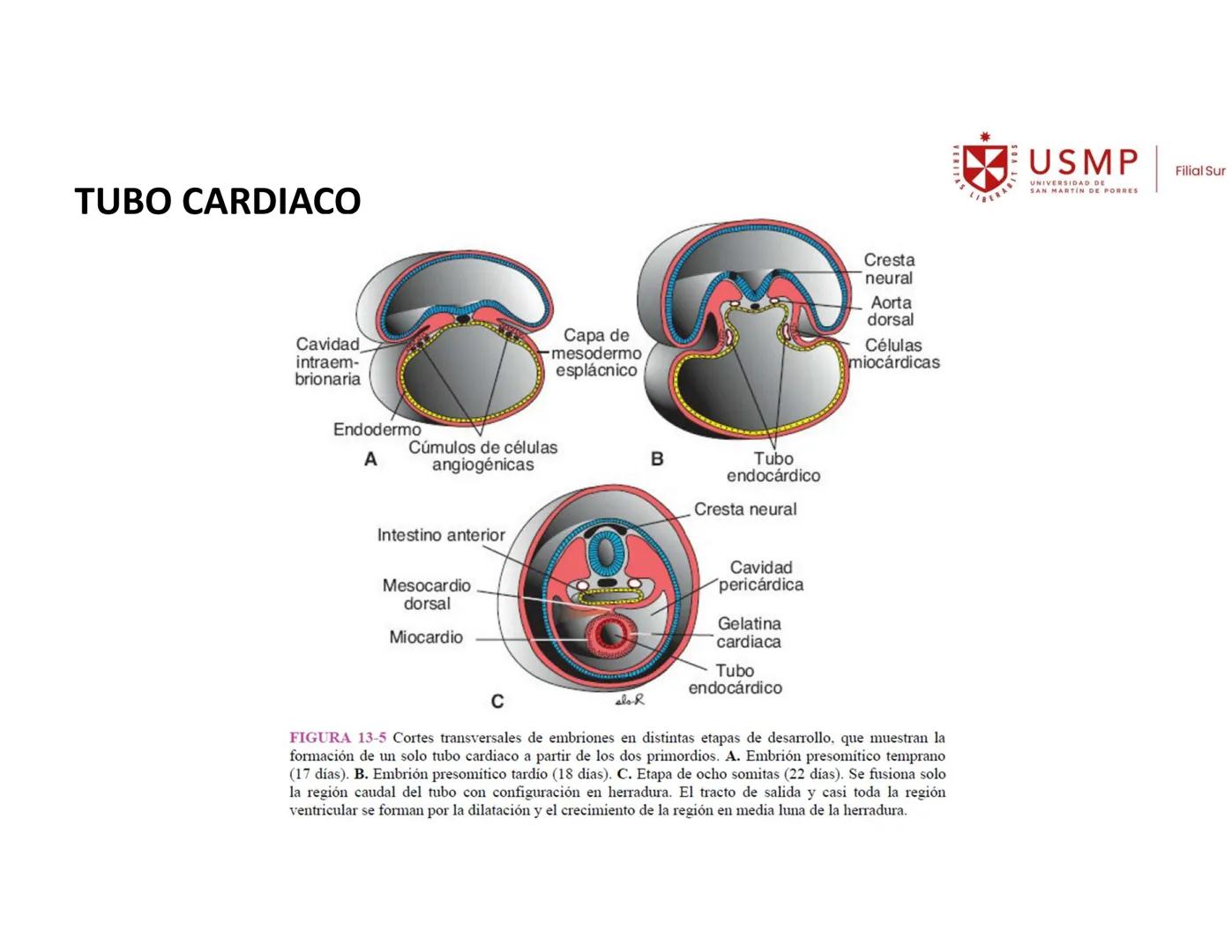 VERITAS
\/BERABITVOS
USMP
UNIVERSIDAD DE SAN MARTIN DE PORRES
FILIAL SUR
PERIODO 2025-1 # SISTEMAS CARDIACO Y RESPIRATORIO
Docente: Mg. Bio