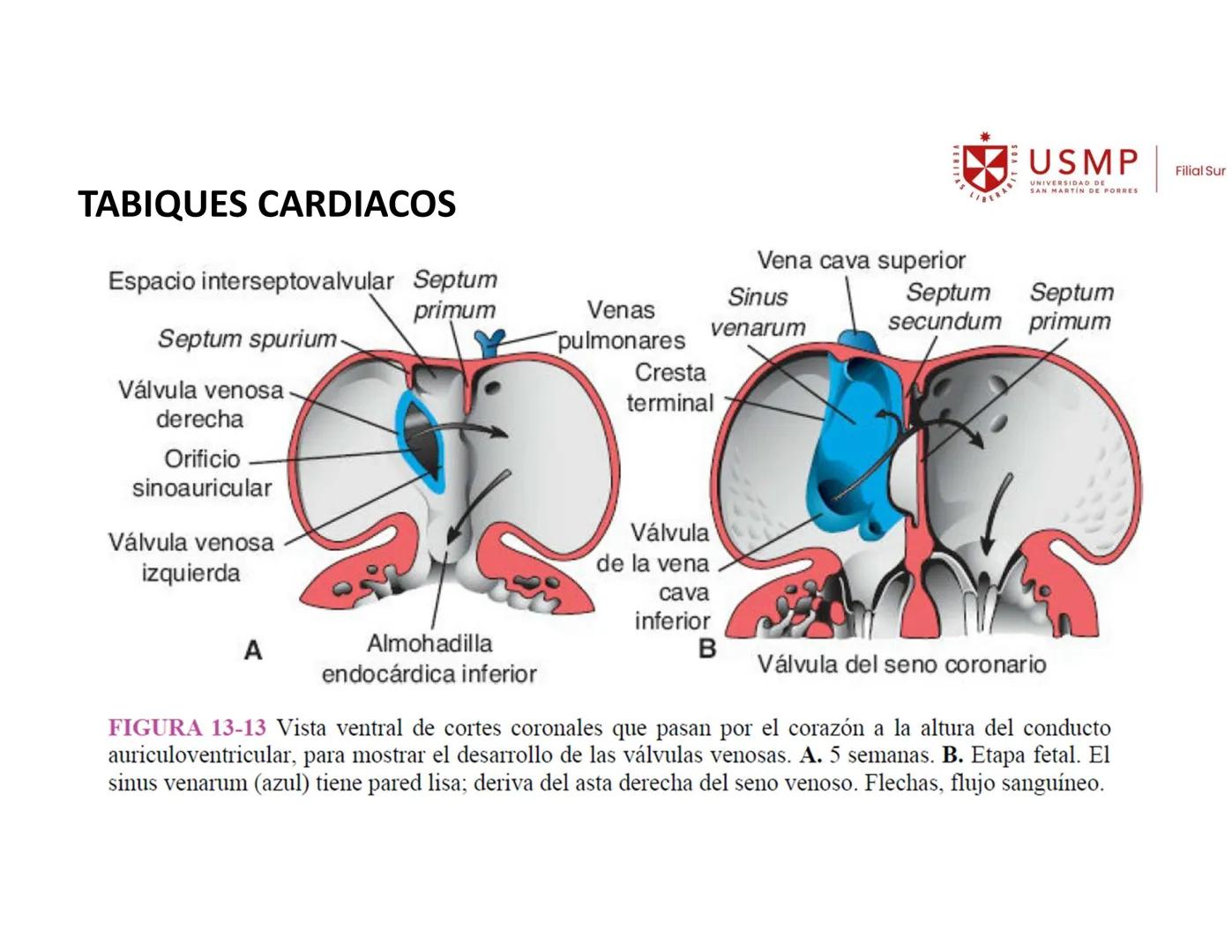 VERITAS
\/BERABITVOS
USMP
UNIVERSIDAD DE SAN MARTIN DE PORRES
FILIAL SUR
PERIODO 2025-1 # SISTEMAS CARDIACO Y RESPIRATORIO
Docente: Mg. Bio