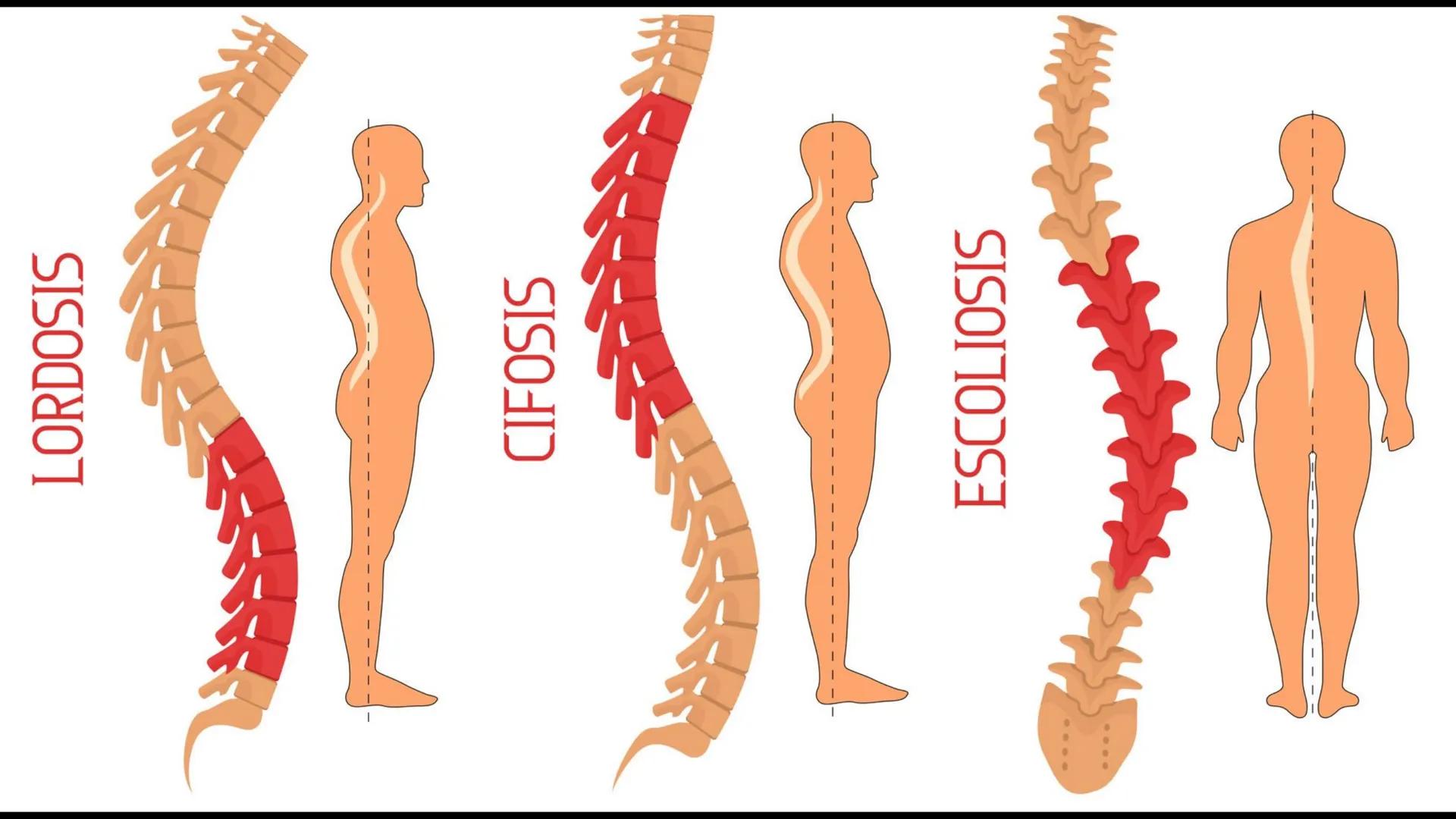 Ceprebicentenario
Cap 2. Octubre 2025 - Ciclo intensivo
Docente: M.C. Gabriel Del castillo S. • 01. El esqueleto axial incluye estructuras