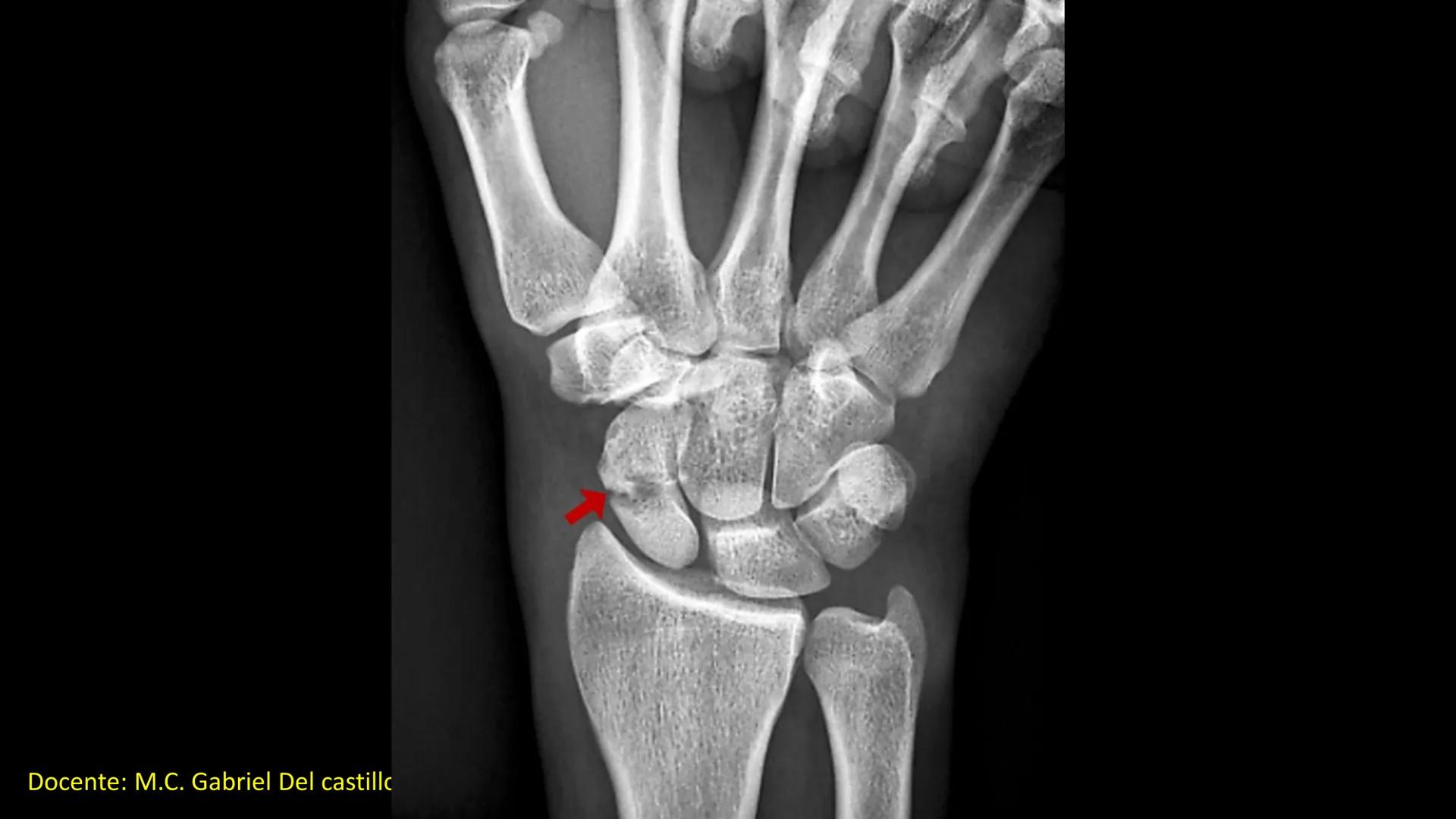 Ceprebicentenario
Cap 2. Octubre 2025 - Ciclo intensivo
Docente: M.C. Gabriel Del castillo S. • 01. El esqueleto axial incluye estructuras