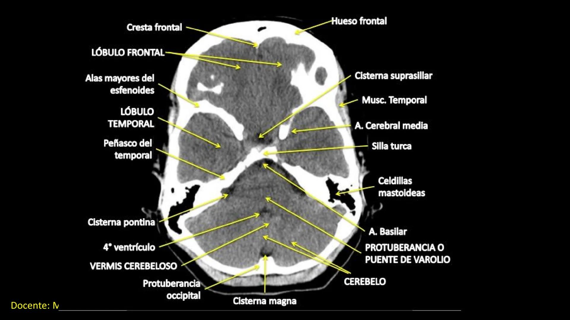 Ceprebicentenario
Cap 2. Octubre 2025 - Ciclo intensivo
Docente: M.C. Gabriel Del castillo S. • 01. El esqueleto axial incluye estructuras
