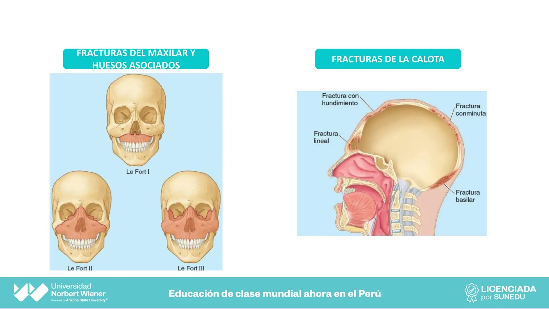 Universidad
Norbert Wiener
Powered by Arizona State University®
VERY GOOD
QS
¡Bienvenidos!
UNIDAD III - Fundamentos Integrados del Siste