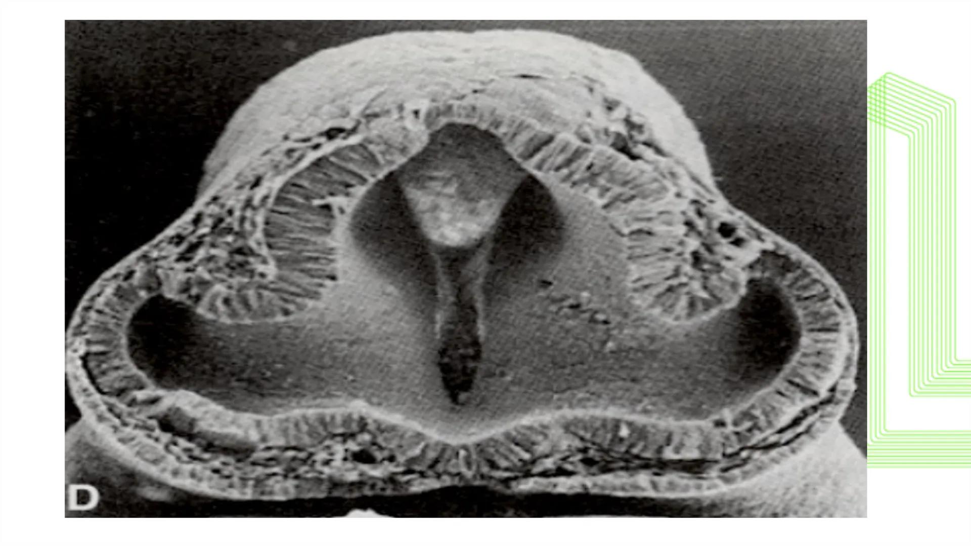 TRANSFORMA TU MUNDO EN
LA U MÁS TOP DE LA REGIÓN. @ussipan
USS
Universidad
Señor de Sipán クク
Universidad
Señor de Sipán
TEMA N° 08
EMBRIO
