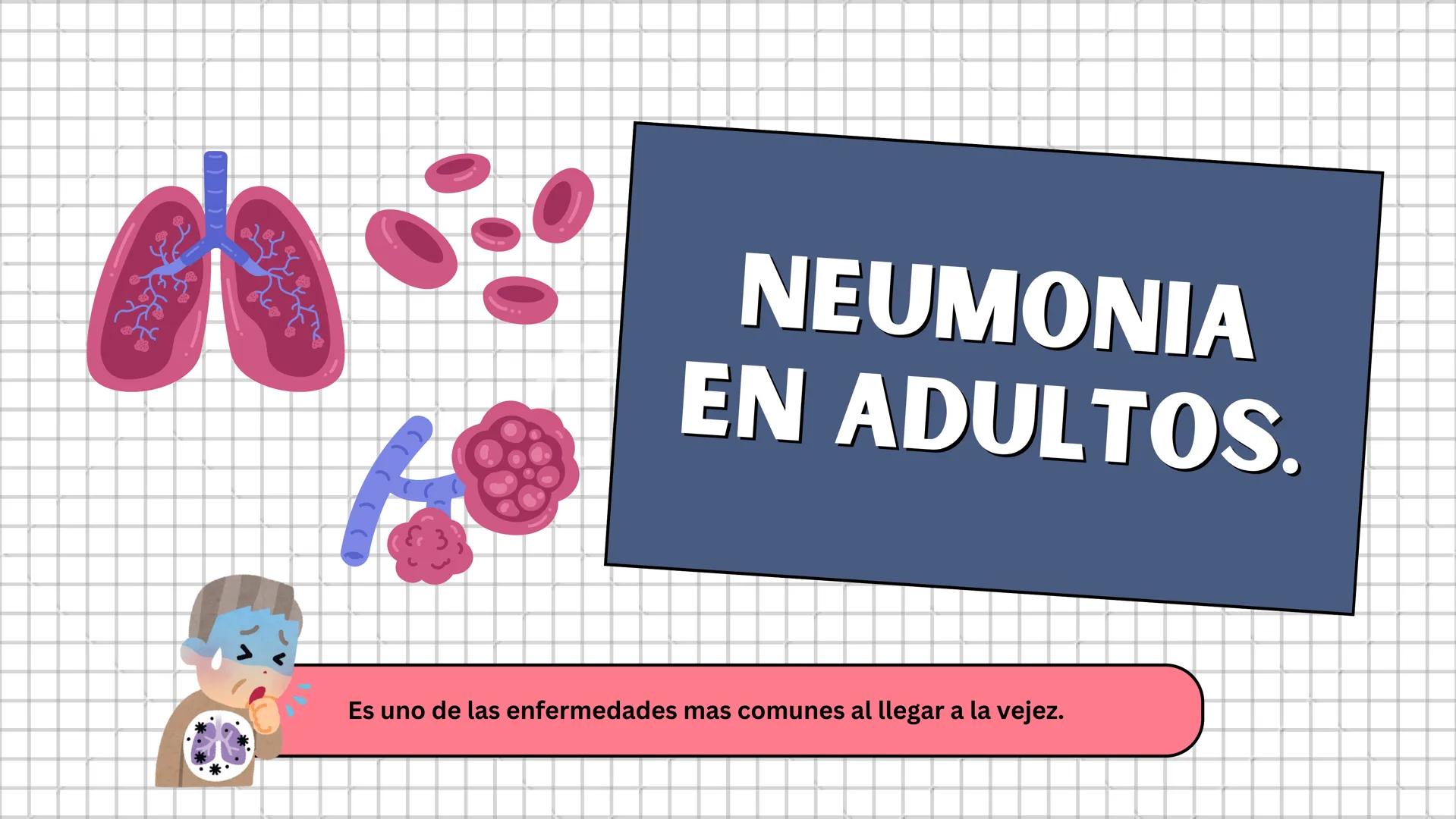# NEUMONÍA Y
# CÁNCER DE PULMÓN
Atención de enfermería al adulto
mayor
Grupo I - Integrantes:
- Rosa Luz Aguilar Huahuasoncco.
- Miriam T