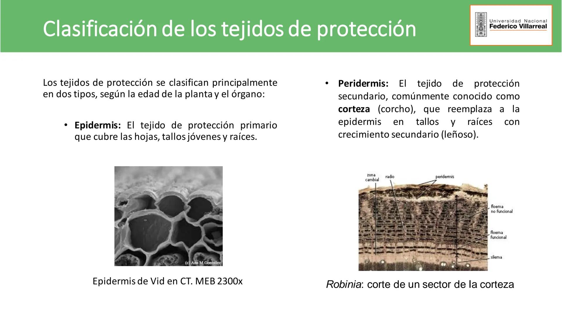 Universidad Nacional
Federico Villarreal
FACULTAD DE CIENCIAS
NATURALES Y MATEMATICA
TEJIDOS ADULTOS: TEJIDOS DE PROTECCIÓN
Docente: Dra