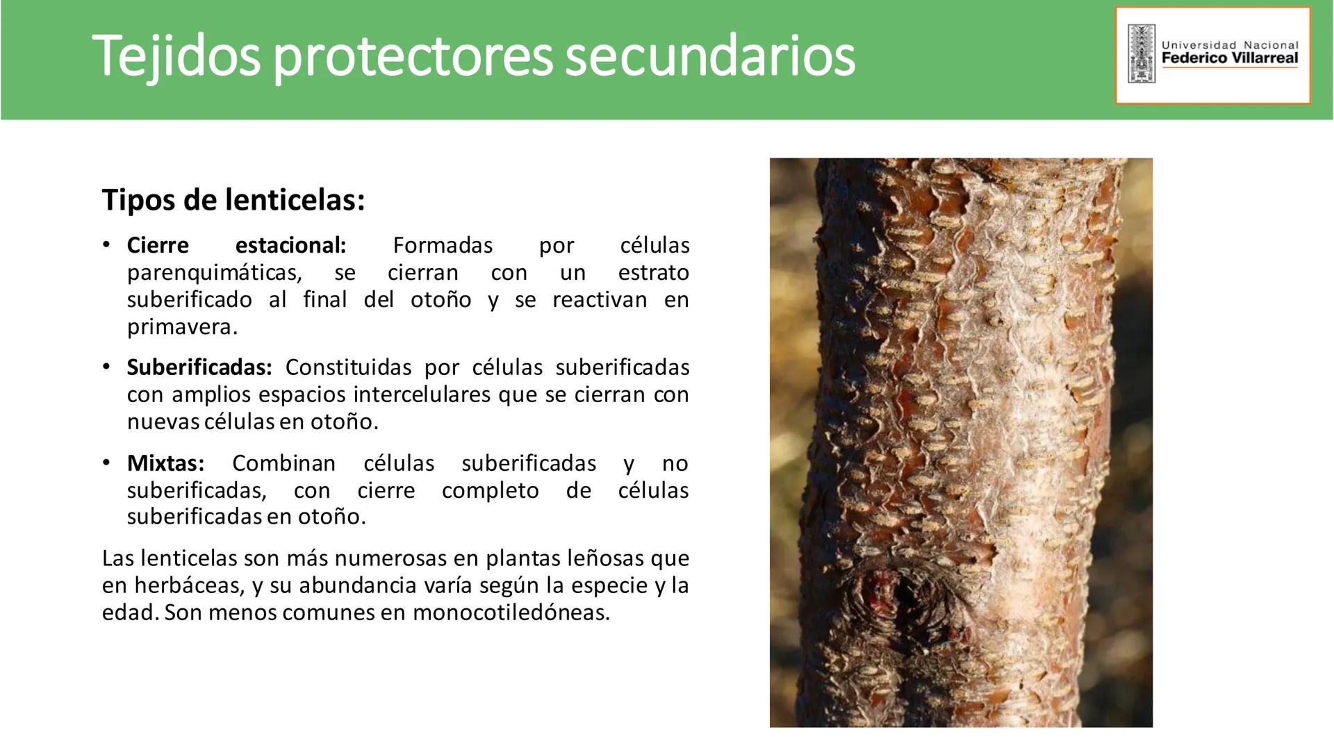 Universidad Nacional
Federico Villarreal
FACULTAD DE CIENCIAS
NATURALES Y MATEMATICA
TEJIDOS ADULTOS: TEJIDOS DE PROTECCIÓN
Docente: Dra