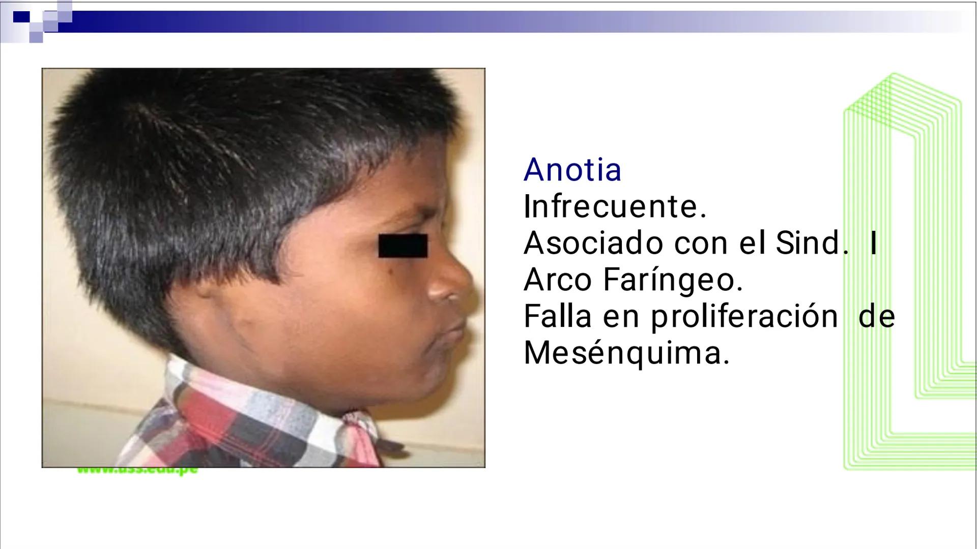 TRANSFORMA TU MUNDO EN
LA U MÁS TOP DE LA REGIÓN. @ussipan
USS
Universidad
Señor de Sipán クク
Universidad
Señor de Sipán
TEMA N° 10
EMBRI