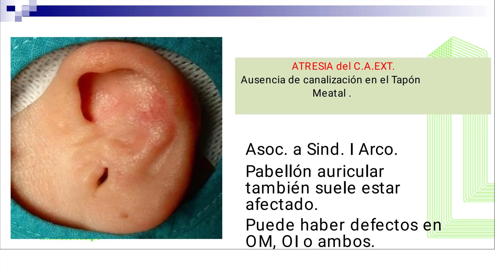 TRANSFORMA TU MUNDO EN
LA U MÁS TOP DE LA REGIÓN. @ussipan
USS
Universidad
Señor de Sipán クク
Universidad
Señor de Sipán
TEMA N° 10
EMBRI